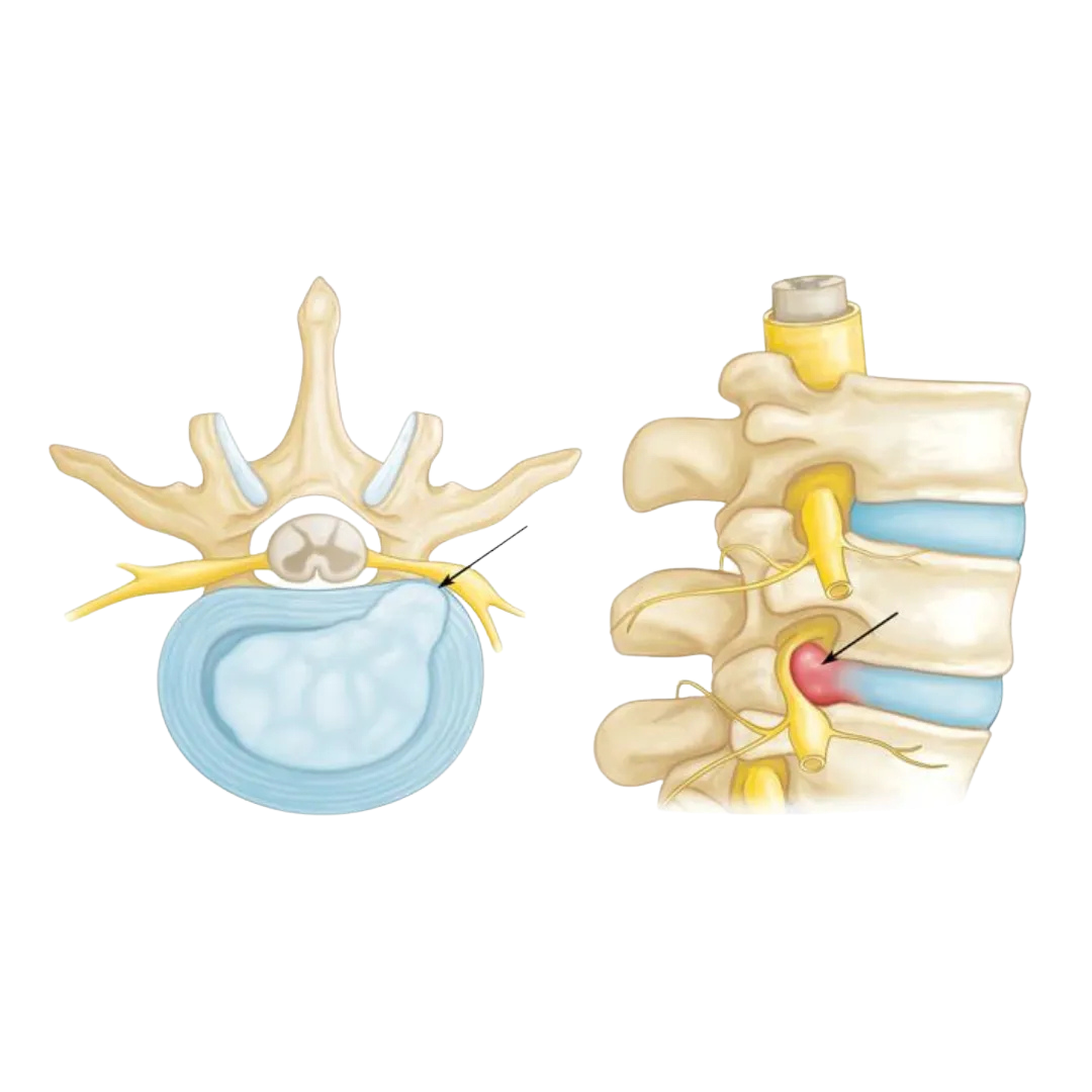 Spine Care